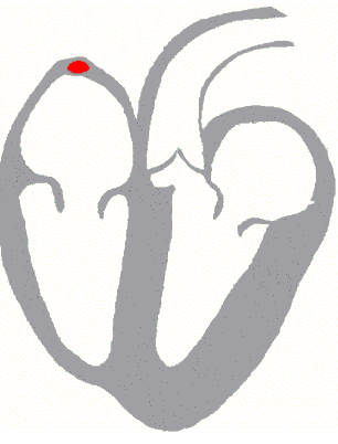 כיצד קוצב הלב והנוירונים במוח יוצרים אותות חשמליים? שניר