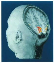 כיצד ניתן למדוד ברגע נתון באיזה צד של המוח יש יותר פעילות חשמלית? שרון