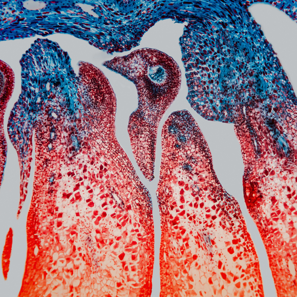 המיקרוטובולים – עמודי התווך של התא