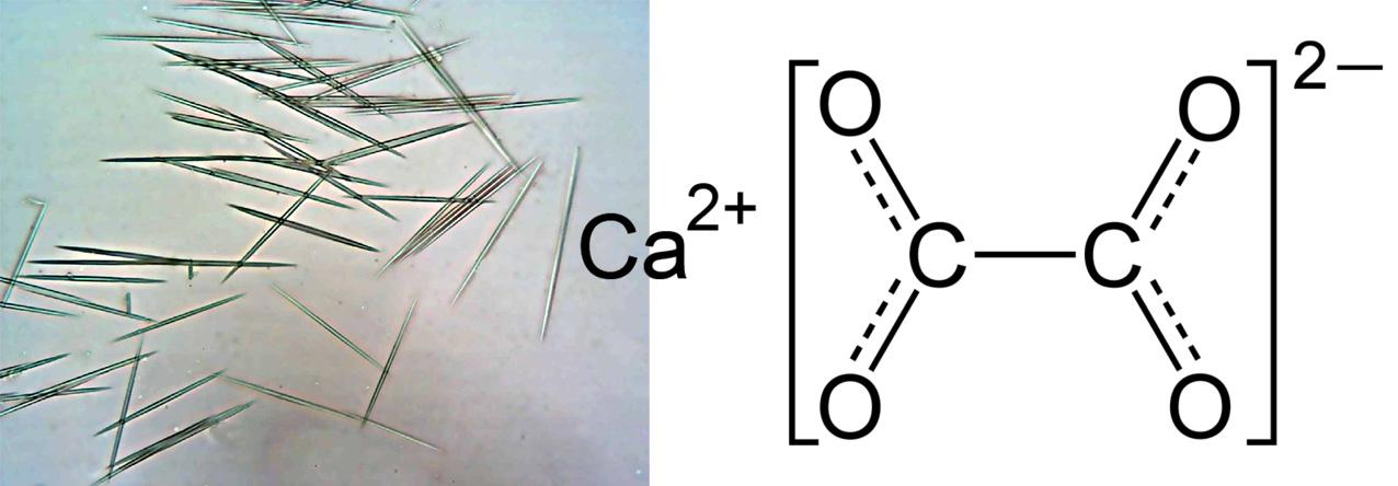 מה המבנה של אוקסלט הסידן, מה הוא עושה לנו מבחינה כימית שהופך אותו לרעיל, ומדוע לימון מנטרל אותו? עדו