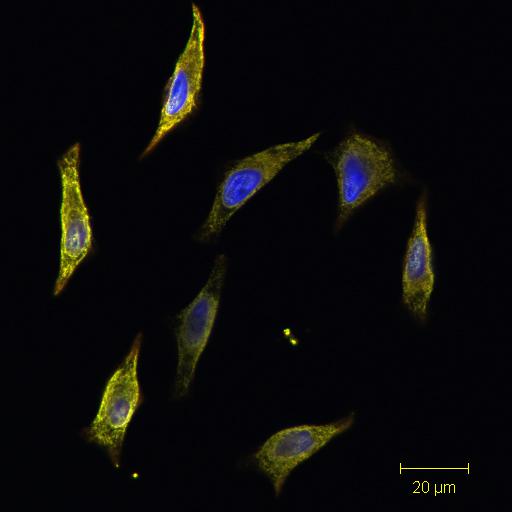 מה הכוונה ב cell-lines; clones מה בעצם באים לבדוק שמנתחים תוצאות אלו של איחוי בין אורגניזמים שונים? לילך