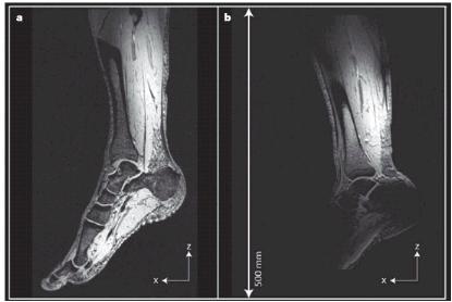 תהודה מגנטית חדשנית – קטן יותר, יעיל יותר, זול יותר