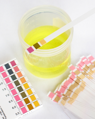 תגובות חומצה-בסיס