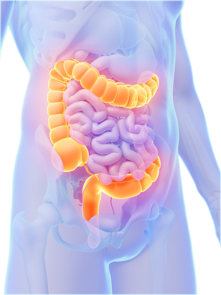 להחלים מסרטן המעי הגס