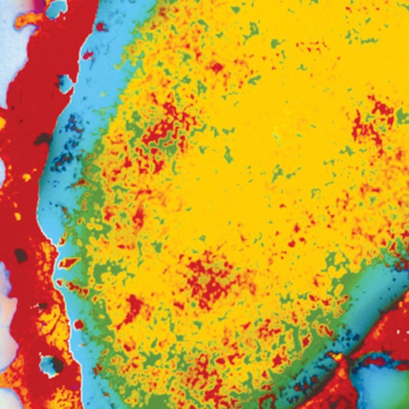 הנתיב הארוך של סימני הסרטן