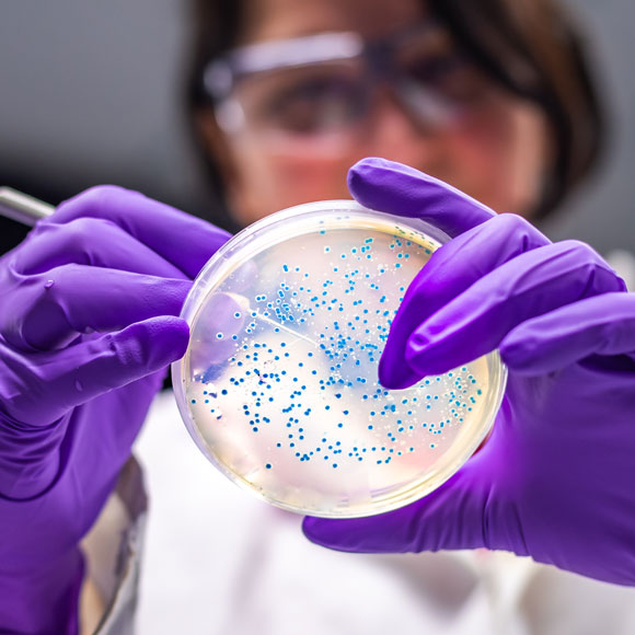 טיפולים גנטיים לחיידקי המעיים