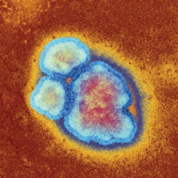 נגיפים נגד סרטן