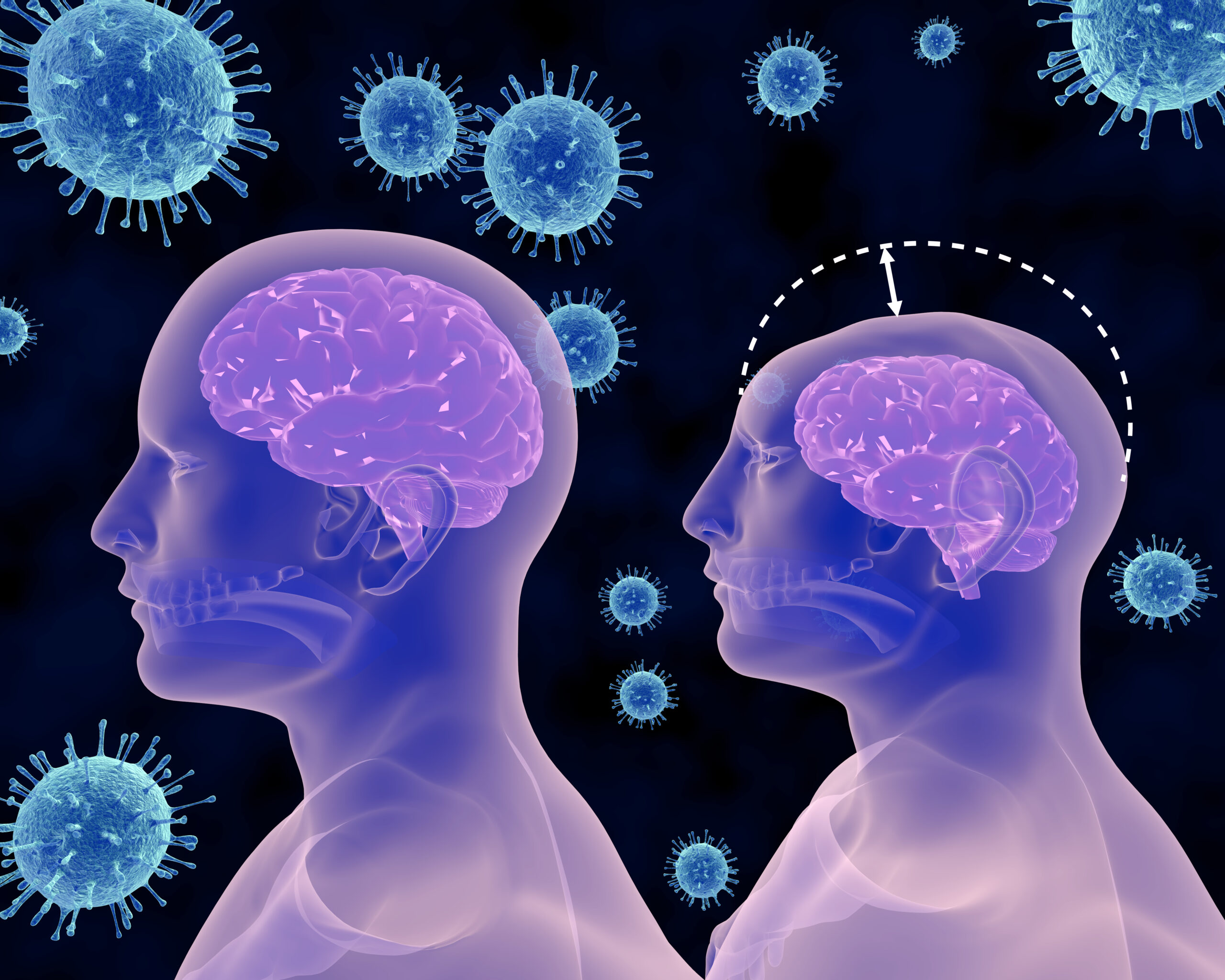 הנגיף שמהלך אימים על היולדות