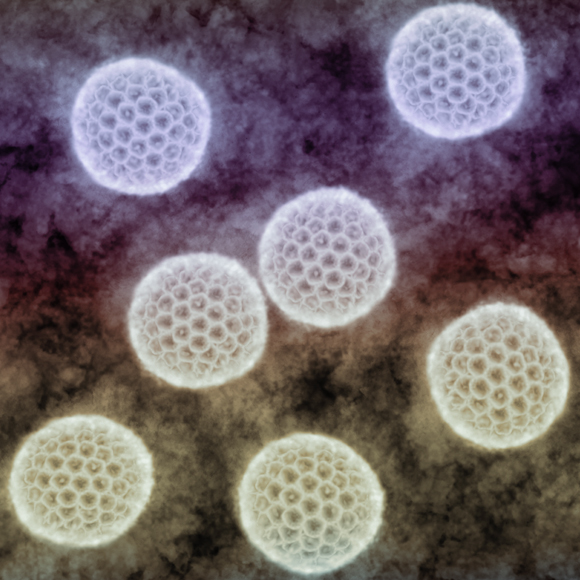 מתרבות העדויות שנגיף הזיקה גורם למיקרוצפליה