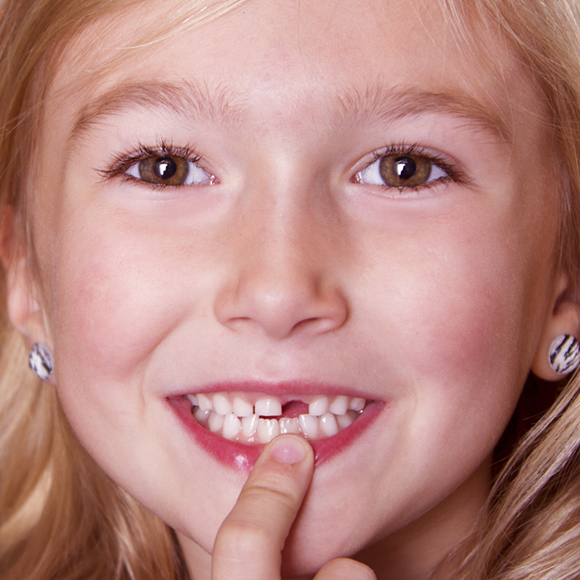 איך משקאות דיאטתיים הורסים את השיניים?