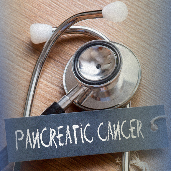 מחקר: סרטן הלבלב – ארבע מחלות שונות