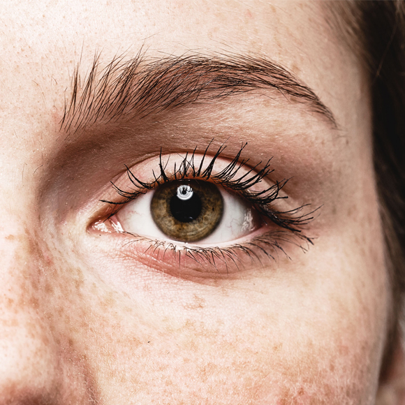 למה לא טוב לאמץ את הראייה?