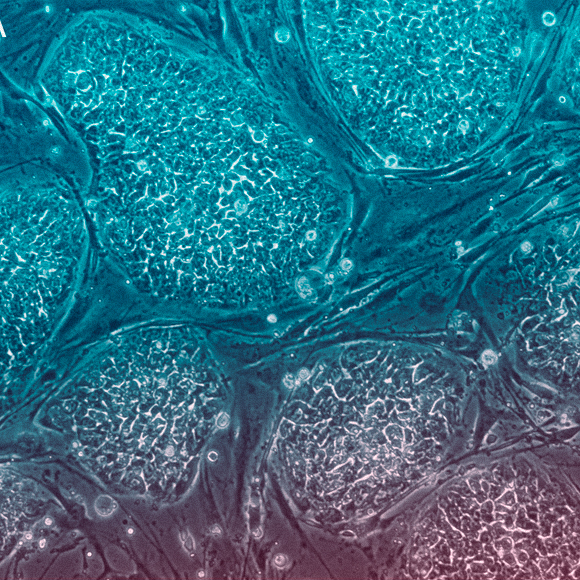 תאי גזע נגד דלדול העצם