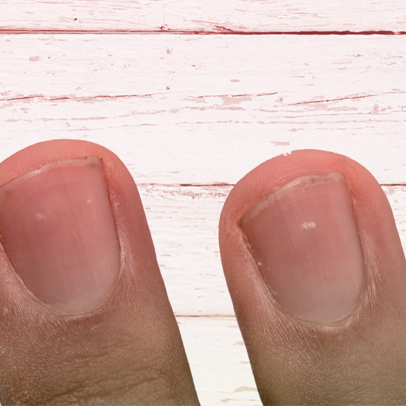 להסתכל בלבן של הציפורניים