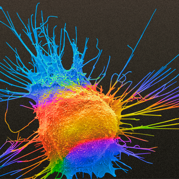 איך סרטן הורג?