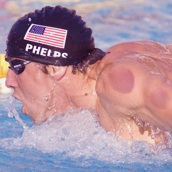 כוסות רוח: עיגולים לא מועילים