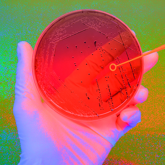 סלמונלה: החיידק שמעורר בהלה