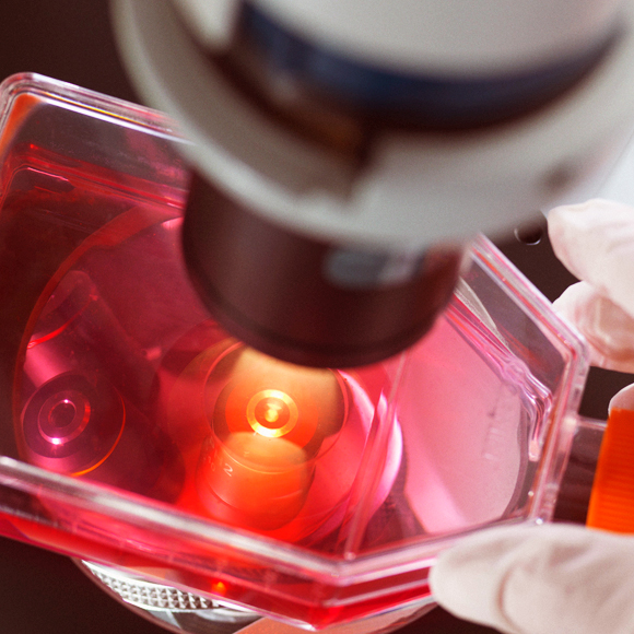 מדע בדקה: נזק לרקמה מגדיל את הסיכון לסרטן