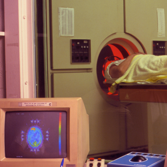 שיטת הדמיה חדשה לגילוי שינויים בהשתקת גנים במוח