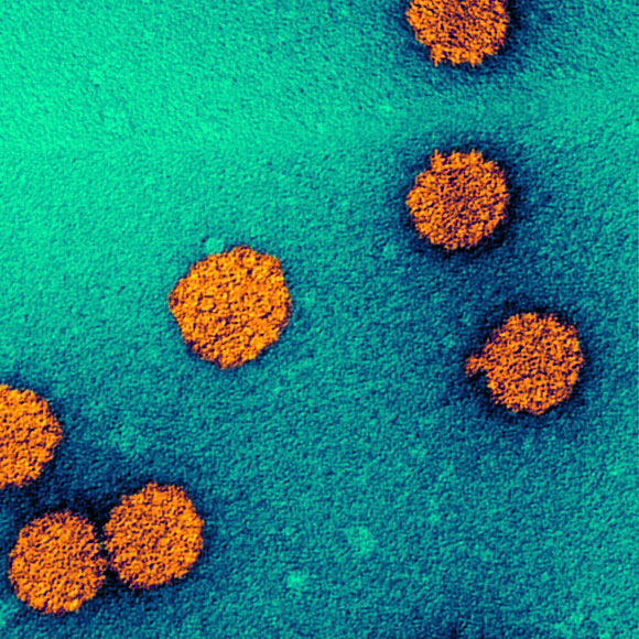 עשור של מחקרים מראה: החיסון נגד פפילומה יעיל