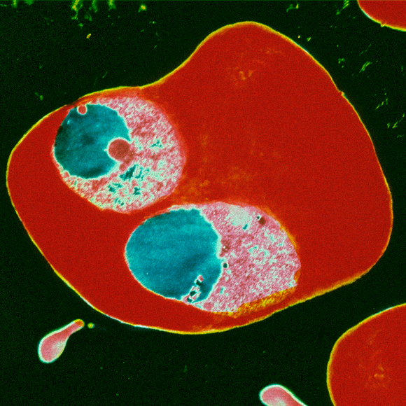 למה יש מחלות קטלניות?