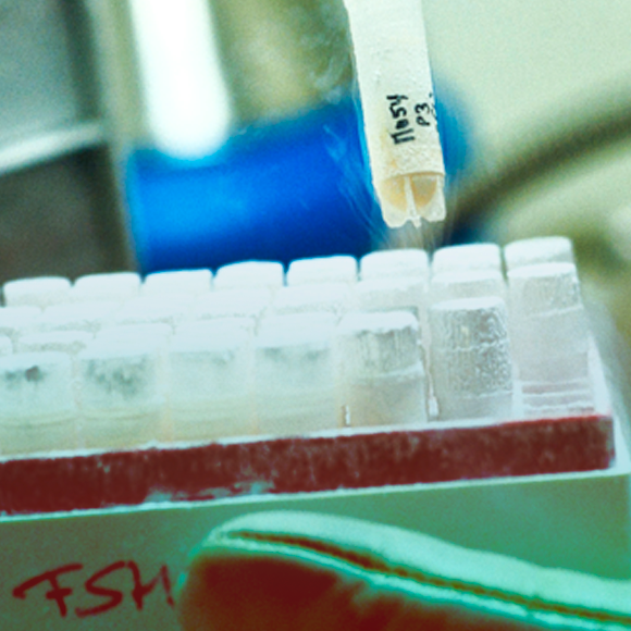 עריכת גנים להקלה על ניוון שרירים