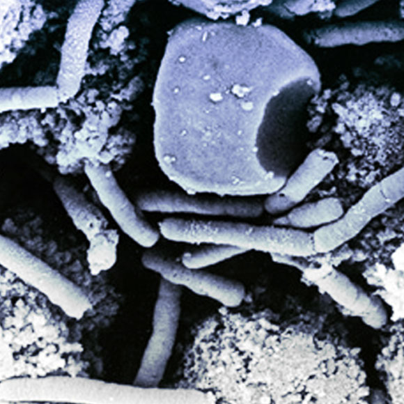 החיידק הקטלני ואסון הנשק הביולוגי