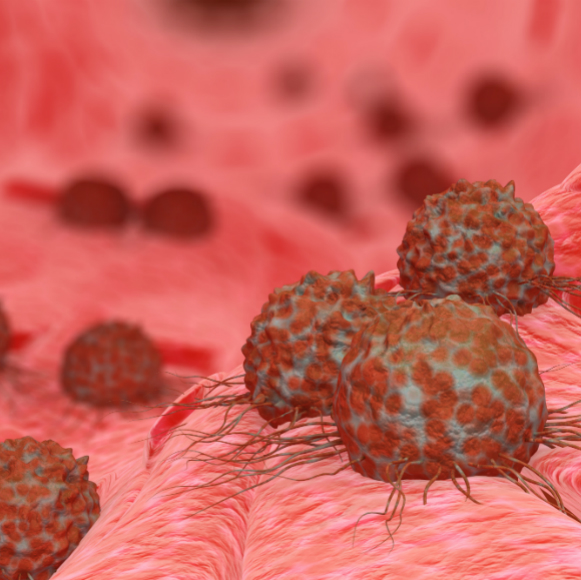 הפצצה המתקתקת של הגרורות