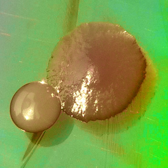 הכיסא החשמלי של חיידקי העל