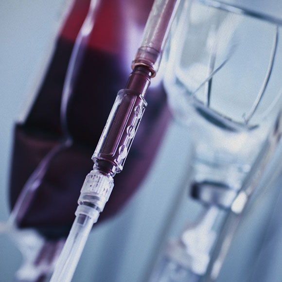 האם יש יתרונות רפואיים לאיבוד דם?