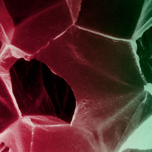 תאי שומן נגד השמנה