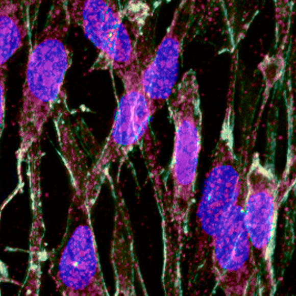 מערכת החיסון נגד אלצהיימר