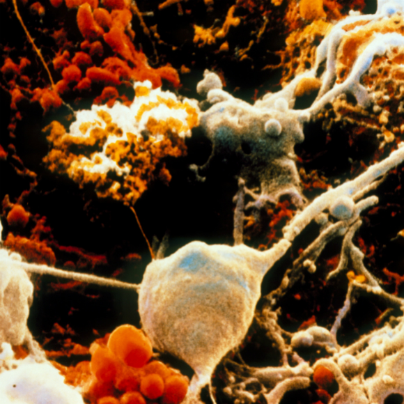 כיצד המוח מזדקן?