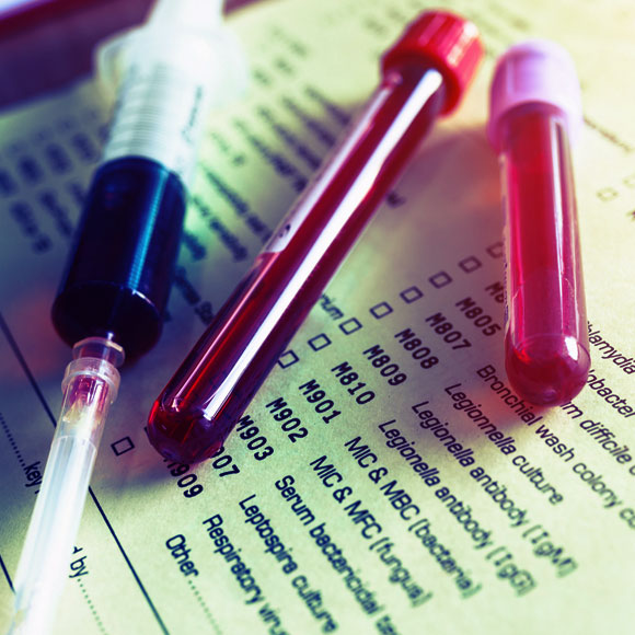 בנק המידע שיעזור לחולי הלוקמיה