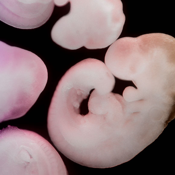 הג’ל שמחליף את הרחם