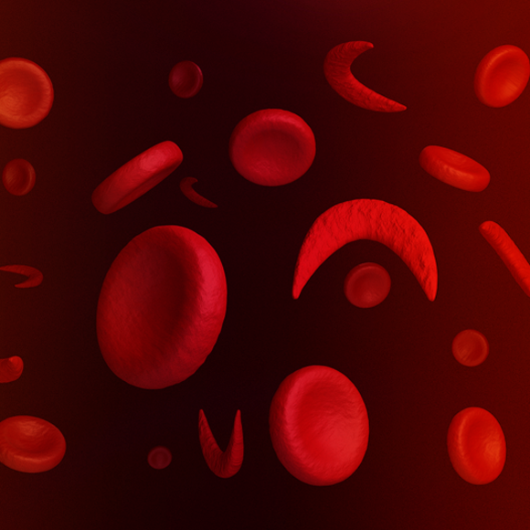 טיפול גֵנִי באנמיה חרמשית