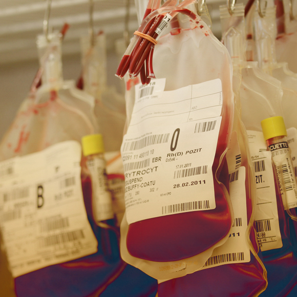 בית חרושת לדם