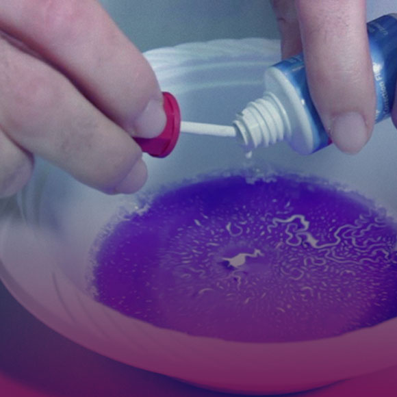 טיפות הטיפקס המשתוללות