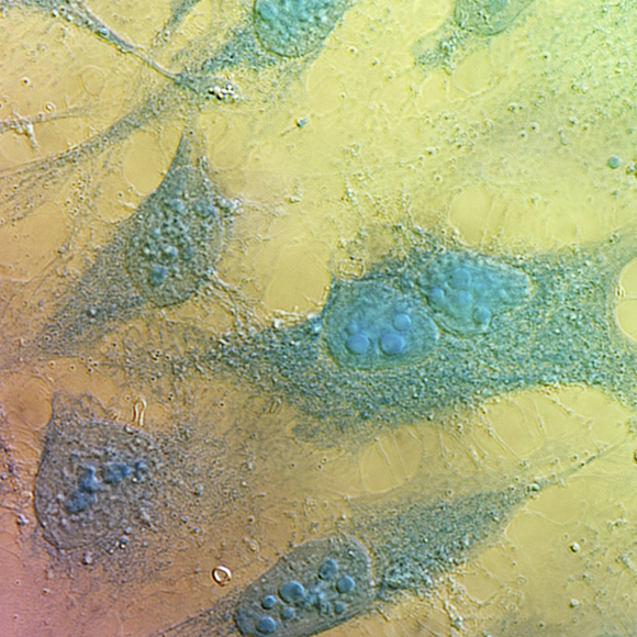 חיי הנצח של התאים הגנובים