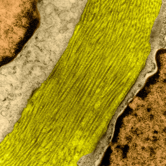 בין שידוך לחיתוך