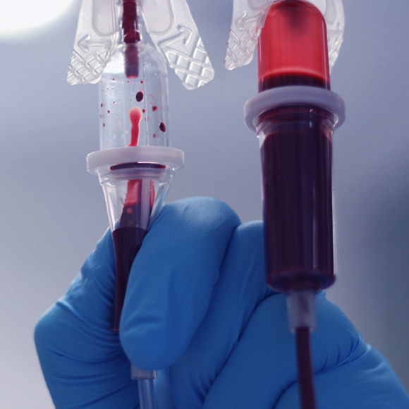 הטיפול שמצעיר עכברים