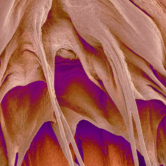 החלבון שמתקן את הלב