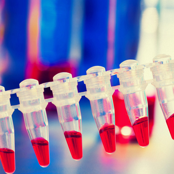 טיפול אימונותרפי ניסיוני במיאלומה