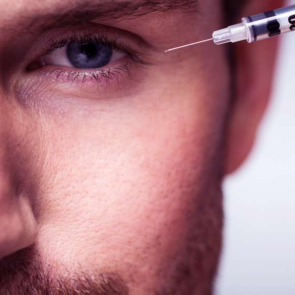 האם אפשר להעלים קמטים?