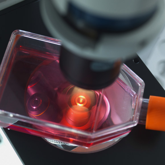 לעקור את הסרטן מהגזע