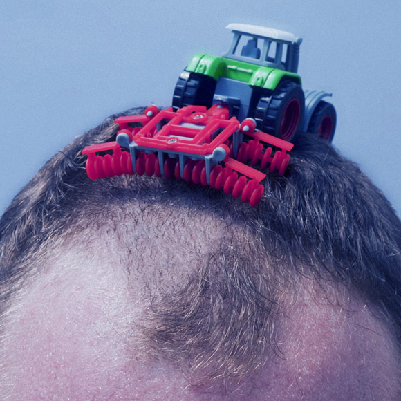 מדוע השיער נושר?