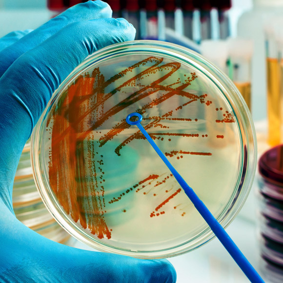 חשש: חיידקי מעיים עלולים לעודד סרטן