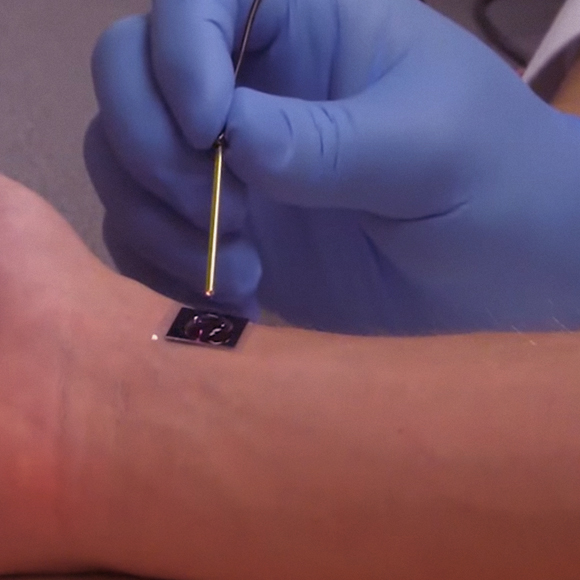 טיפול גנטי במגע