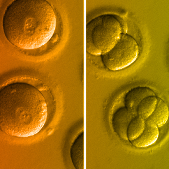 בפעם הראשונה: תיקון גנטי מוצלח בעובר אדם