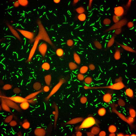 החיידקים שעוזרים לגידול הסרטני